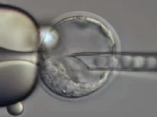 ES_InjectionSeq1.png